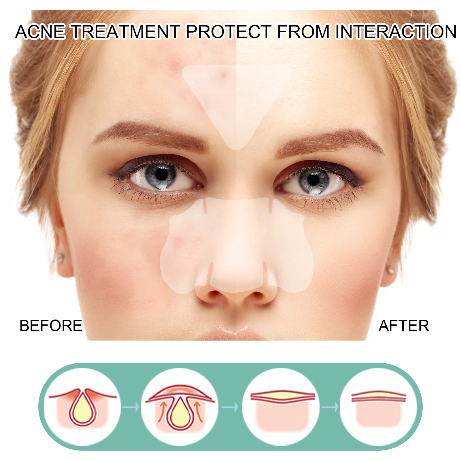 132Pcs Acne Pimple Patch Breathable Invisible Hydrocolloid Sticker Blemish Treatment Patches Relief Redness Pimple Care Stickers - Image 3
